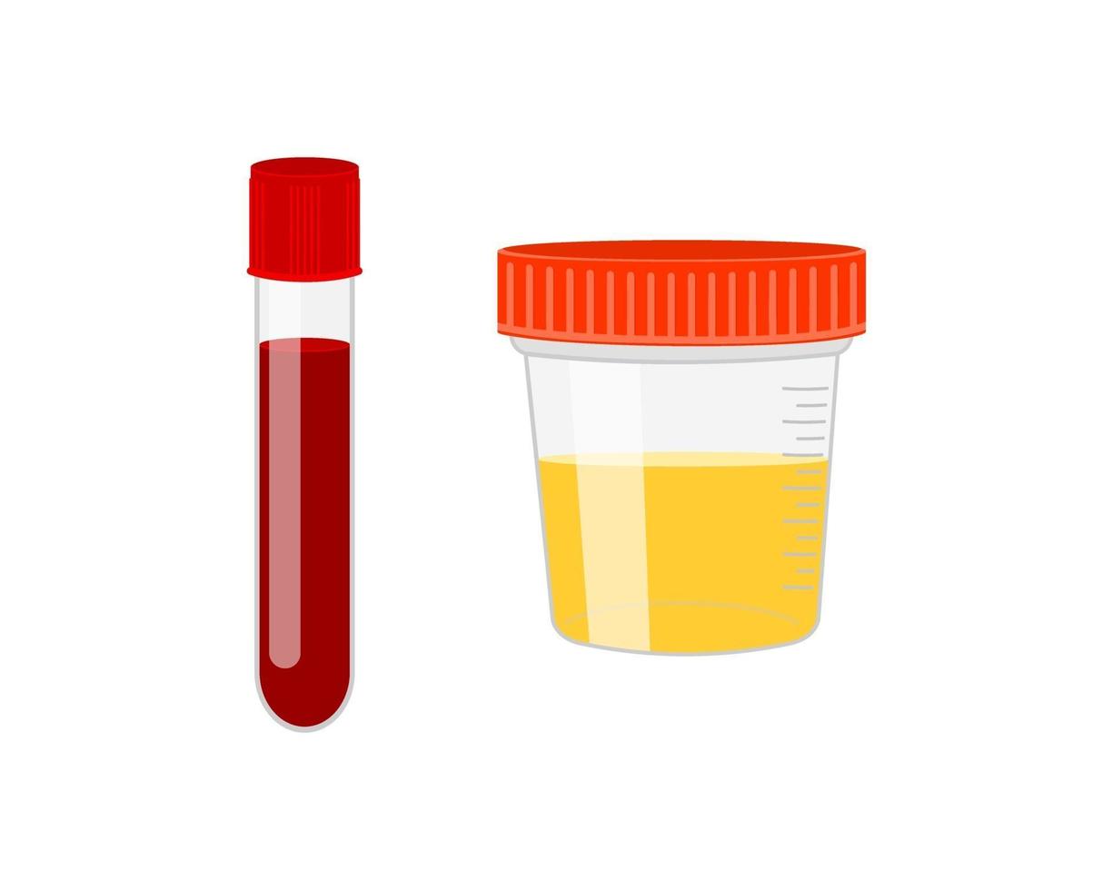 tubo de ensaio com recipiente de amostra de sangue e urina isolado no fundo branco. urinálise, ícones de análise médica de sangue. conceito de exame laboratorial e diagnóstico vetor