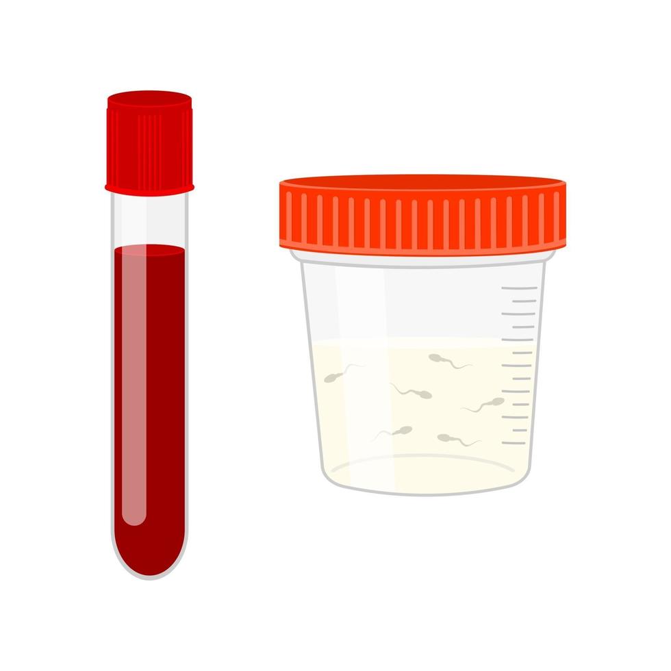 testes de infertilidade masculina. análise de sangue e sêmen. sangue em tubo de vidro e esperma em recipiente de plástico vetor