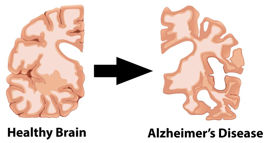 Uma anatomia humana do cérebro vetor