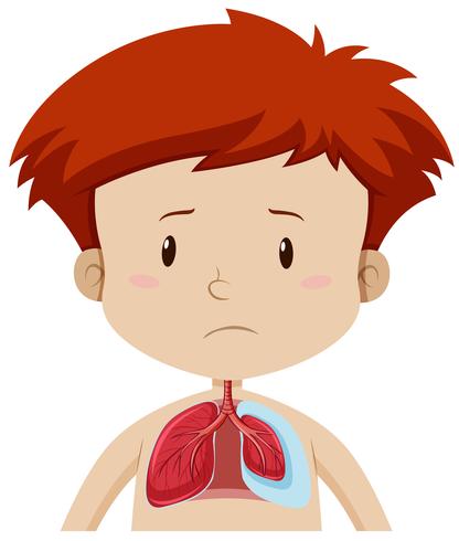 Um garoto com doença pulmonar vetor