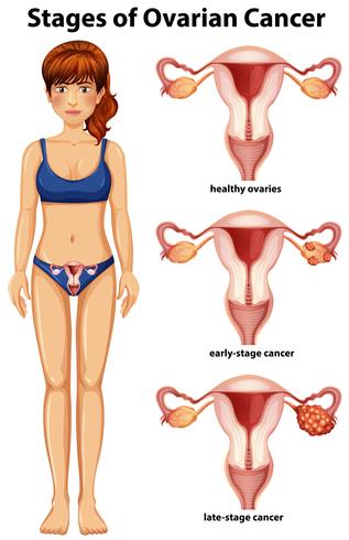 Um vetor de estágios do ovário feminino