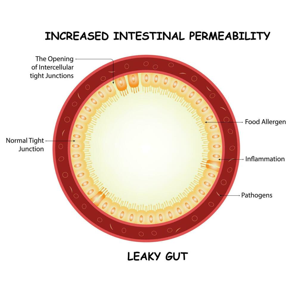 aumentado intestinal permeabilidade Projeto vetor ilustração