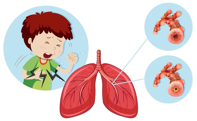 Um homem com Doença Pulmonar Obstrutiva Crônica vetor