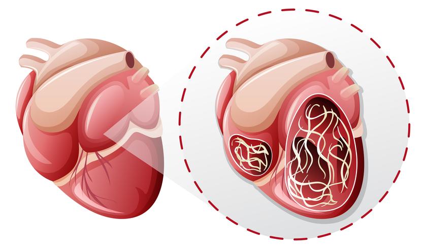 conceito de verme coração ampliada vetor