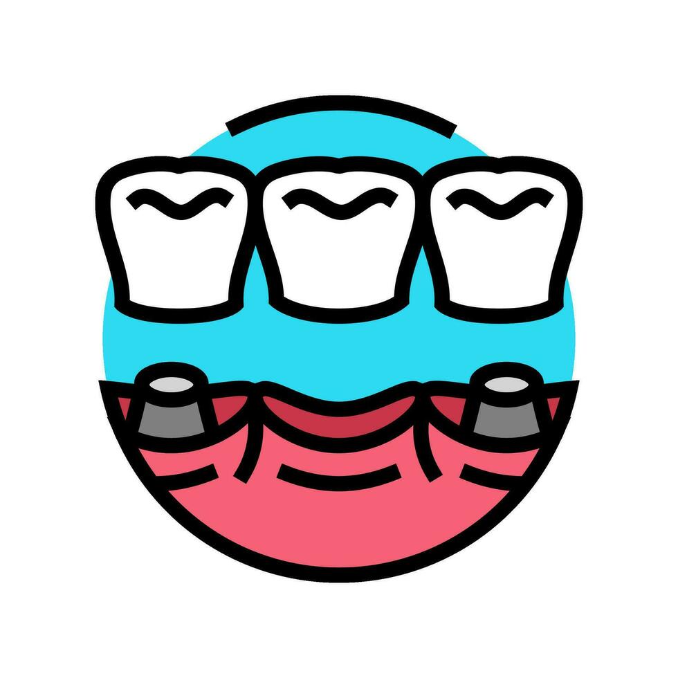 ponte dental procedimento cor ícone vetor ilustração