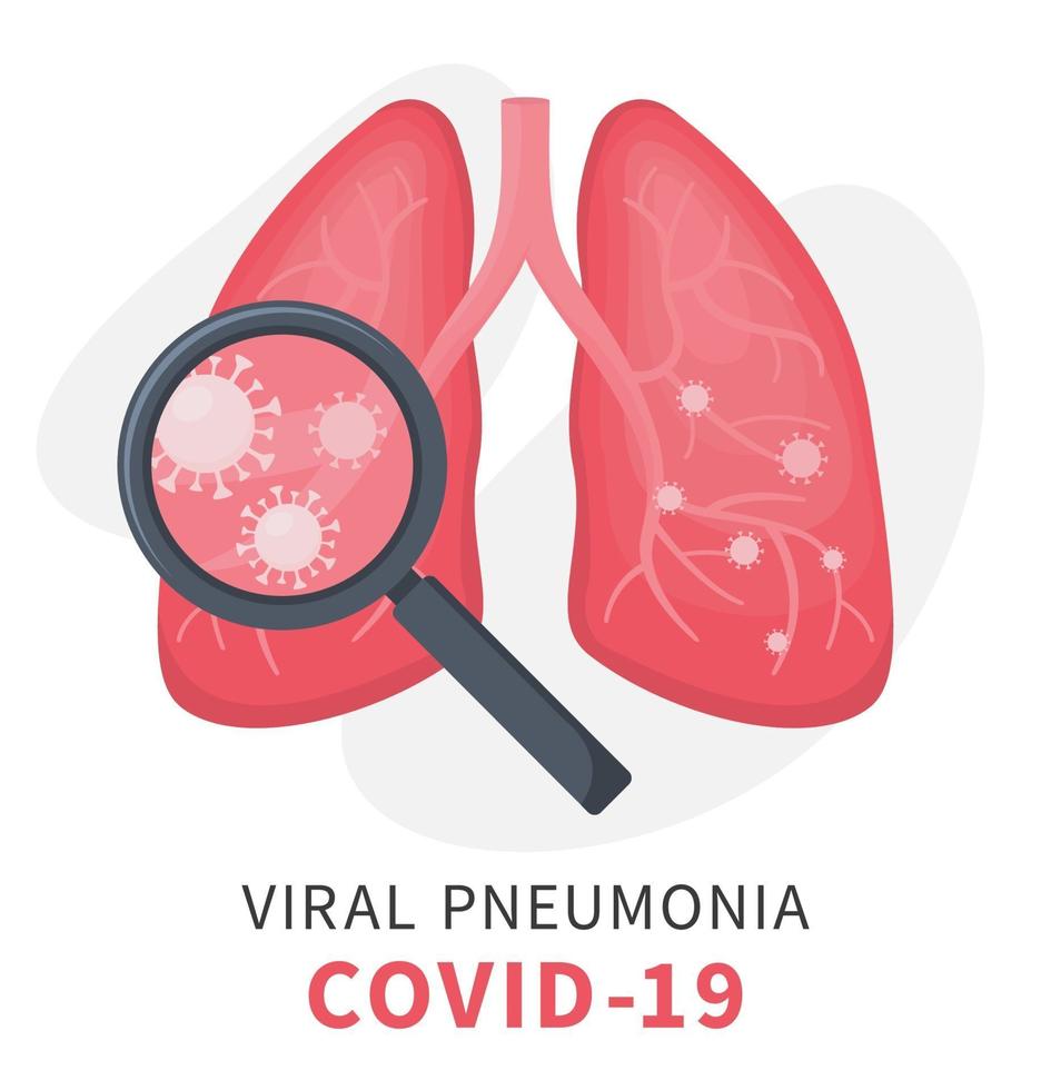 pulmões humanos sob pneumonia viral com covid 19 vetor