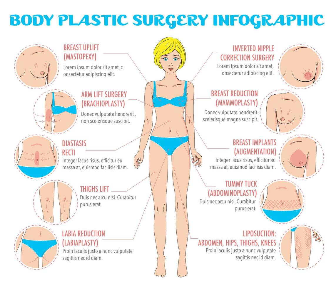 infográficos de cirurgia plástica corporal vetor