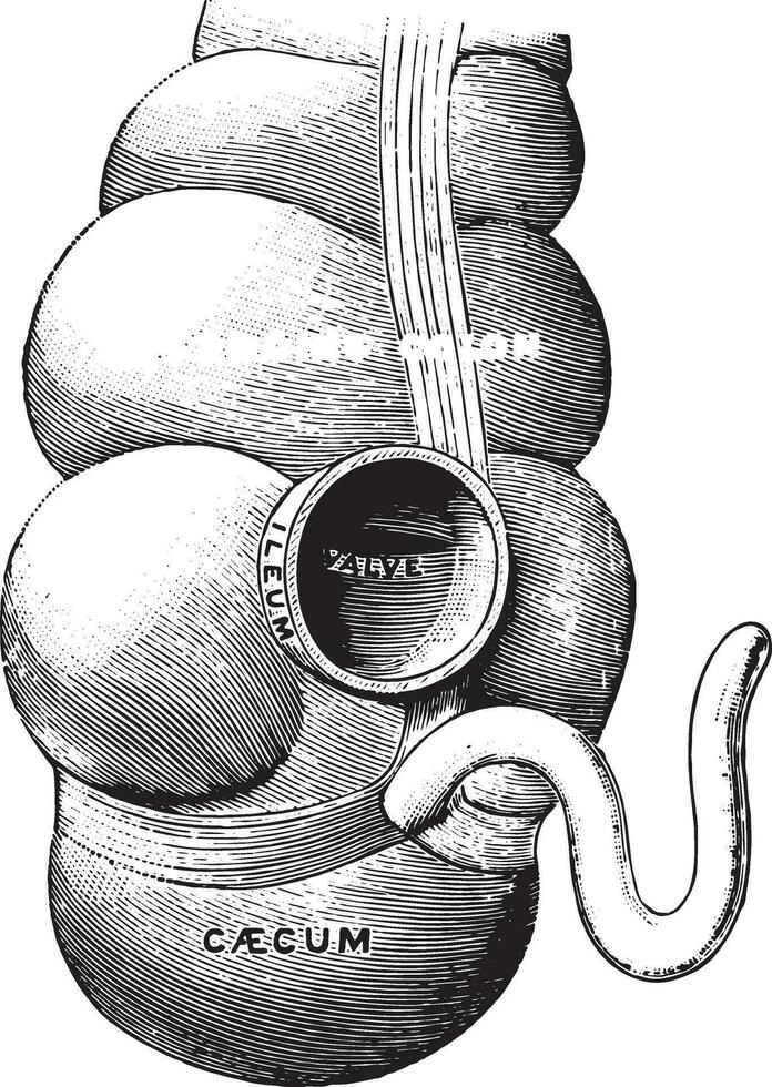 diagrama ilustrando a União do a pequeno intestinos com a grande, vintage gravação. vetor