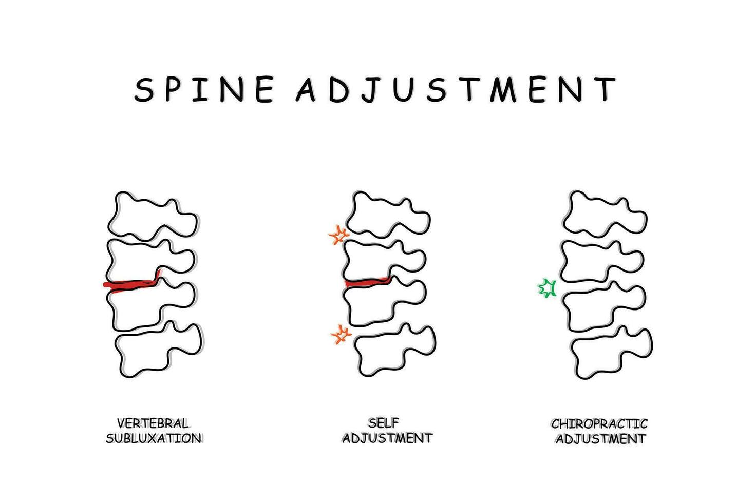 linha arte do quiropraxia coluna vertebral ajustes. vetor