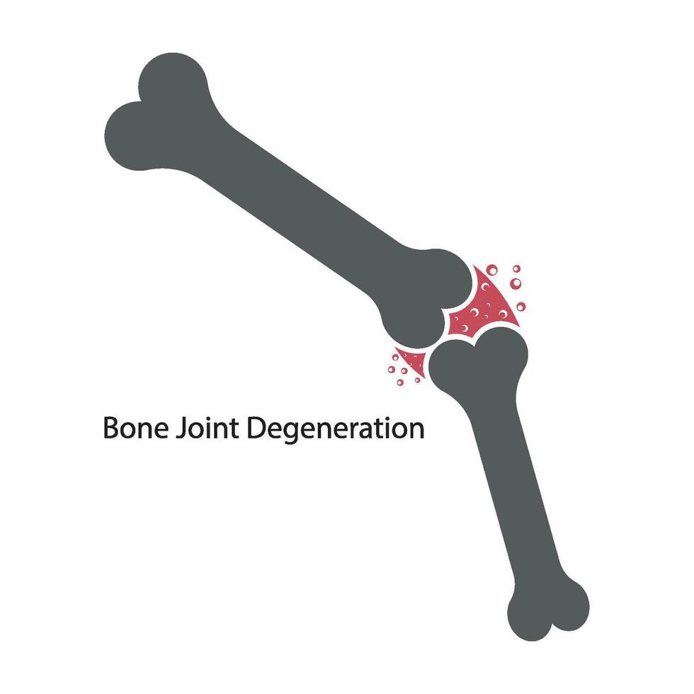 osso articulação degeneração ícone vetor