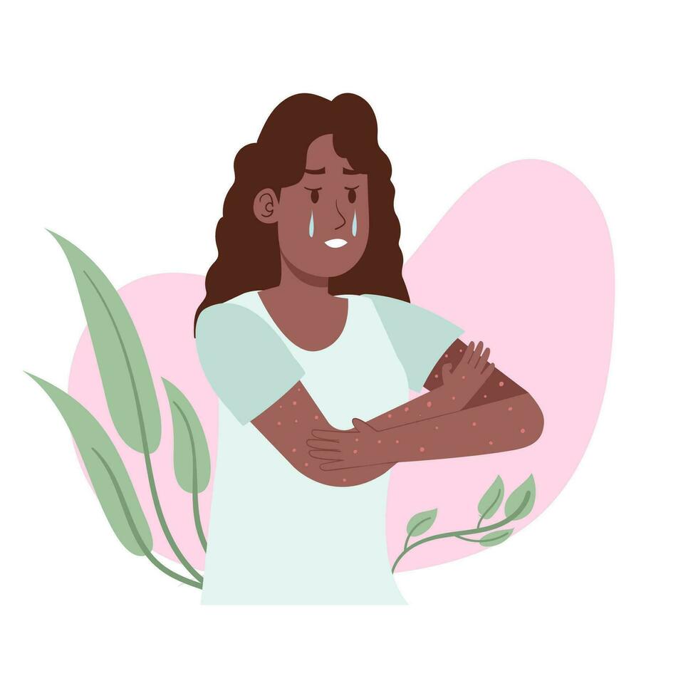 Preto mulher comichão às mão ou irritação eczema vencimento para alergia sensível pele problema ilustração com folhas decoração vetor
