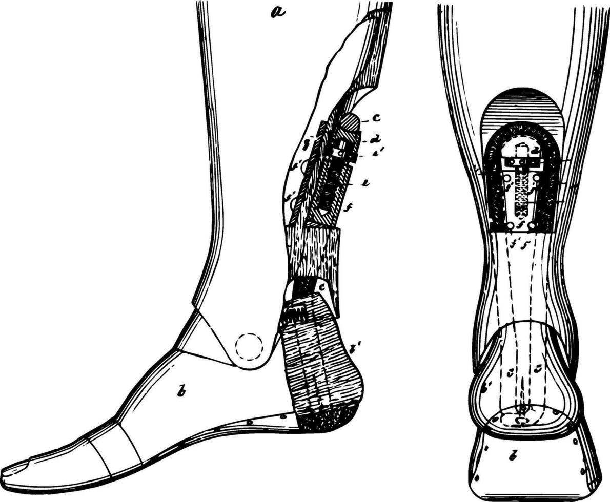 sulcado artificial perna, vintage ilustração vetor