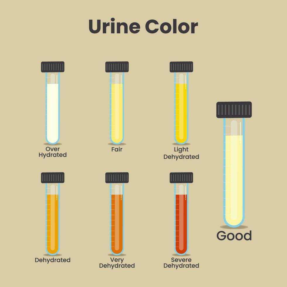 urina cor dentro teste tubos vetor ilustração