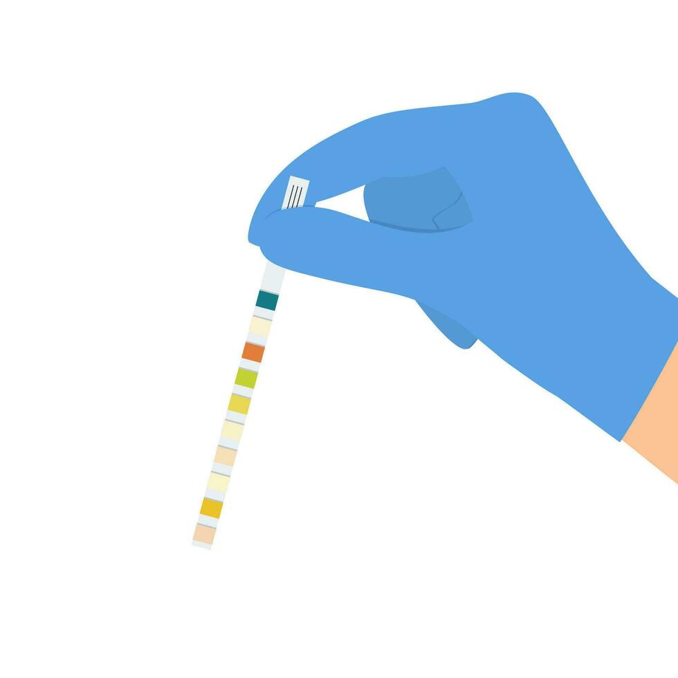 mão dentro branco luva segurando urina faixa para diagnóstico urinário trato infecção isolado em branco fundo. médico exame. vetor ilustração dentro plano estilo