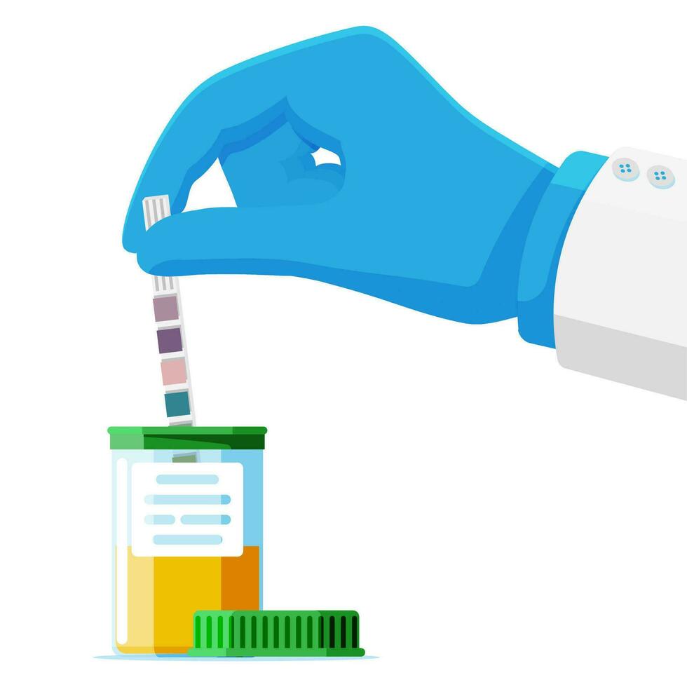 mão do médico segurando urina ph teste faixa dentro jarra isolado. laboratório urina teste amostra. diagnóstico urinário trato infecção. urológico análise e exame. plano vetor ilustração