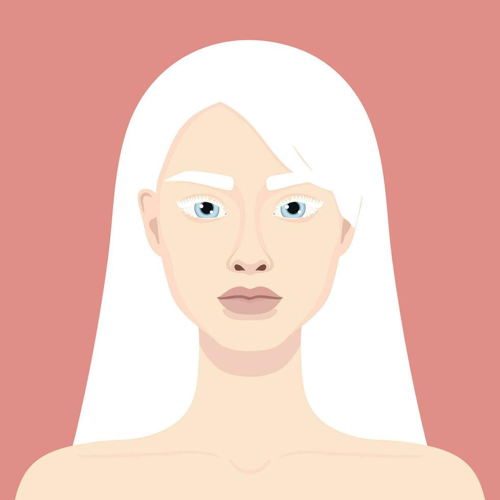 albino mulher retrato. avatar do uma menina com albinismo. genético raro aparência. vetor ilustração
