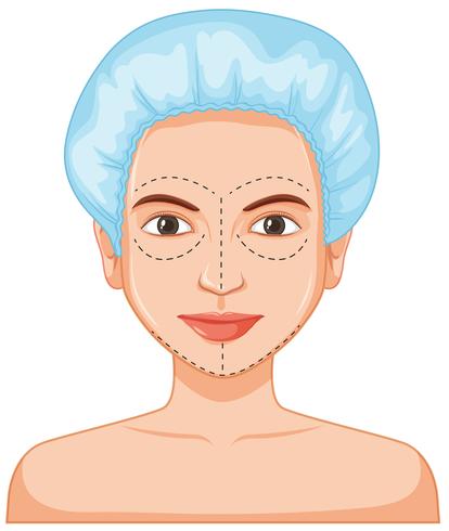 Lady pele facial botox vetor