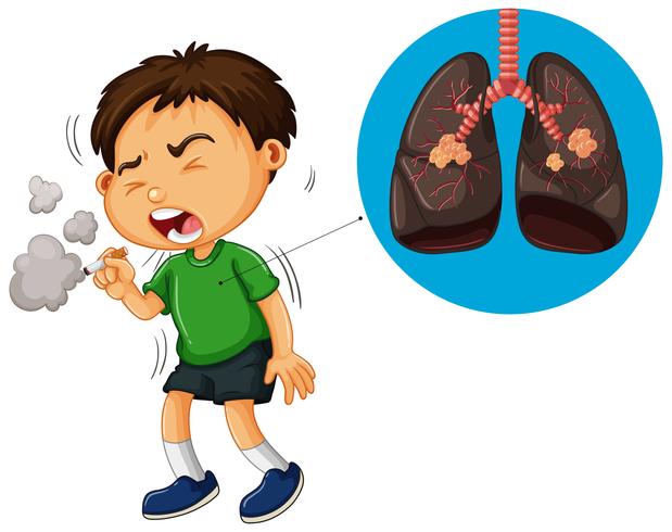 Cigarro de fumar menino e diagrama de pulmões insalubres vetor