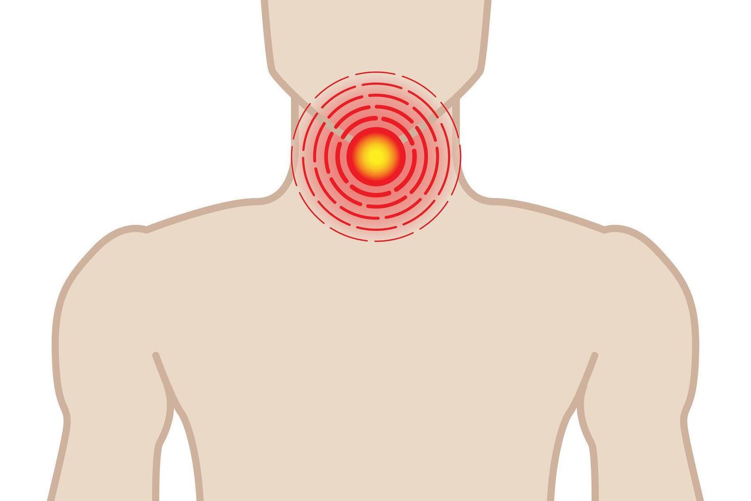 dolorido garganta ilustração com homem em branco fundo vetor