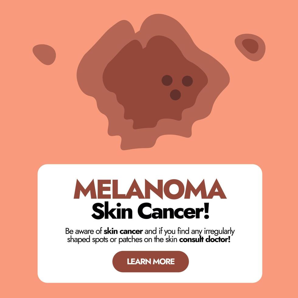 melanoma pele Câncer célula. pele doença, infecção, doença, espinha, ver. pele problemas consciência social meios de comunicação publicar. melanoma consciência bandeira para guiando pessoas. vetor