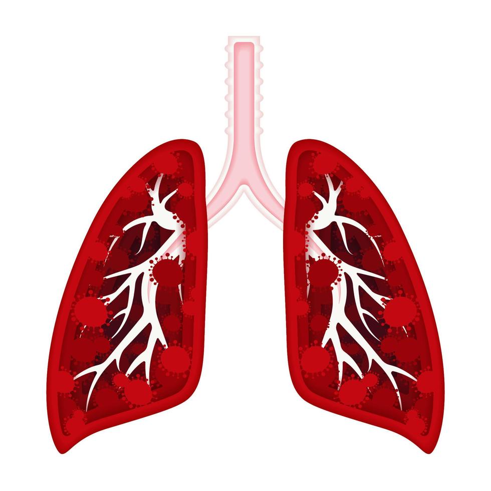 coronavírus, 2019-ncov. pulmões infectados com vírus. pneumonia, gripe, resfriados, infecções virais. ilustração do estilo de papel. ilustração em vetor de estoque em um fundo branco.