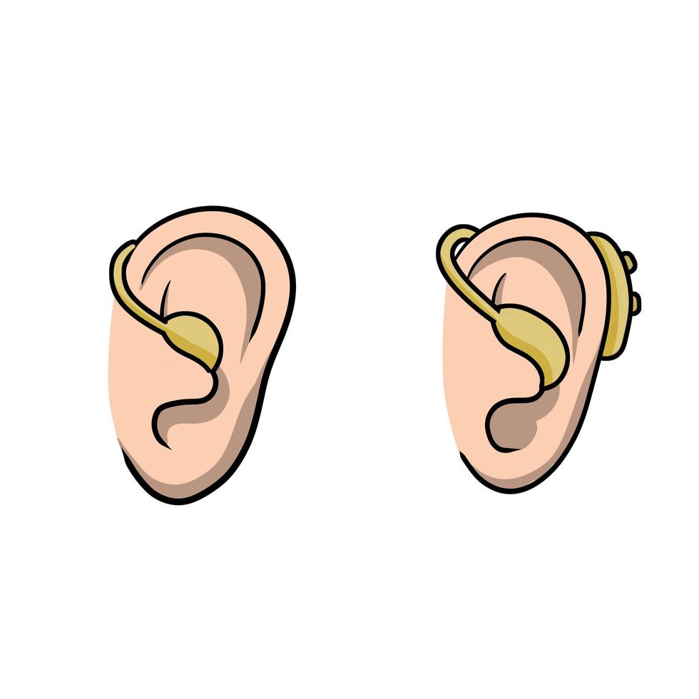 aparelho auditivo. problemas de audição vetor