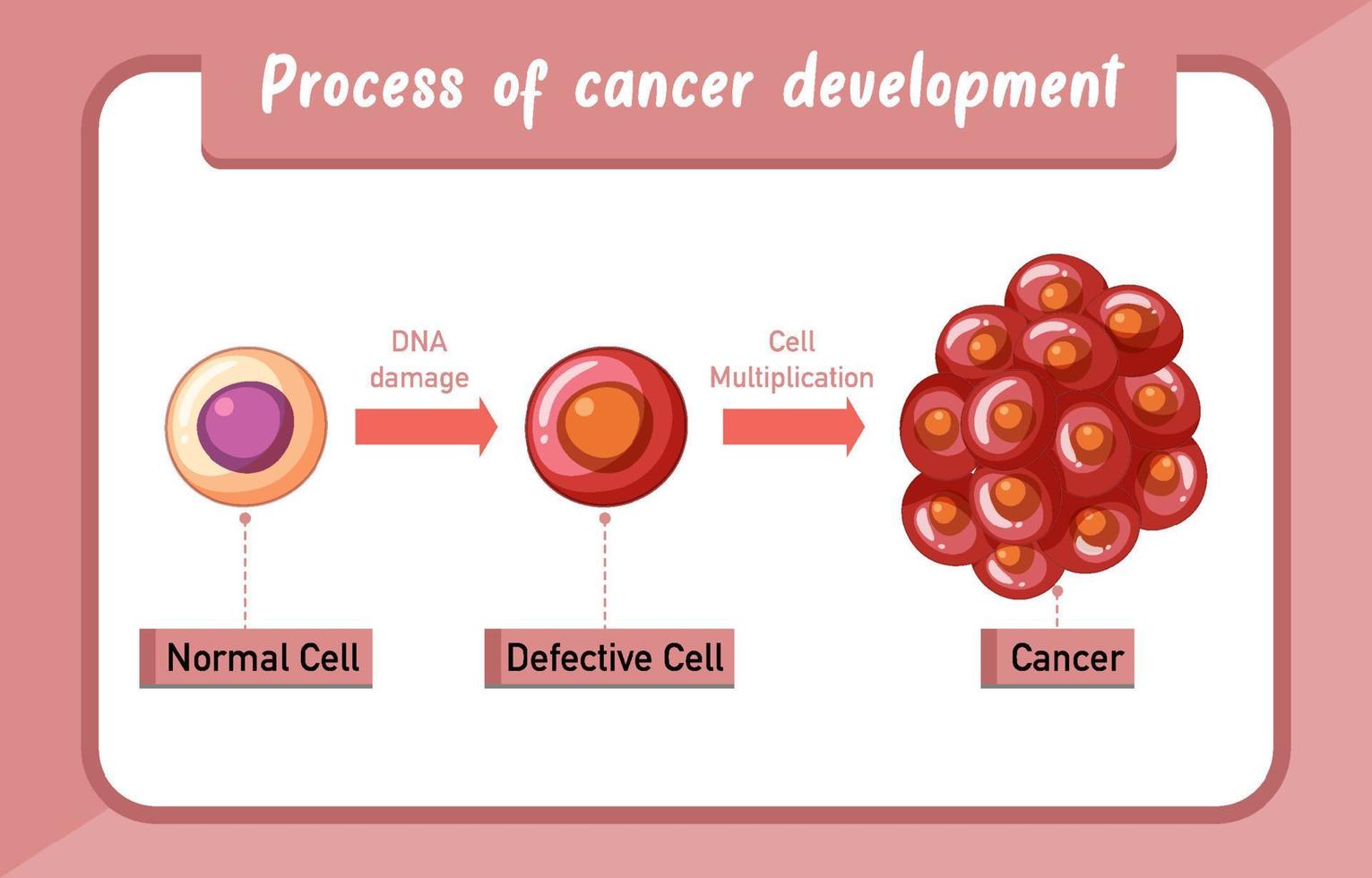processo de infográfico de desenvolvimento de câncer vetor