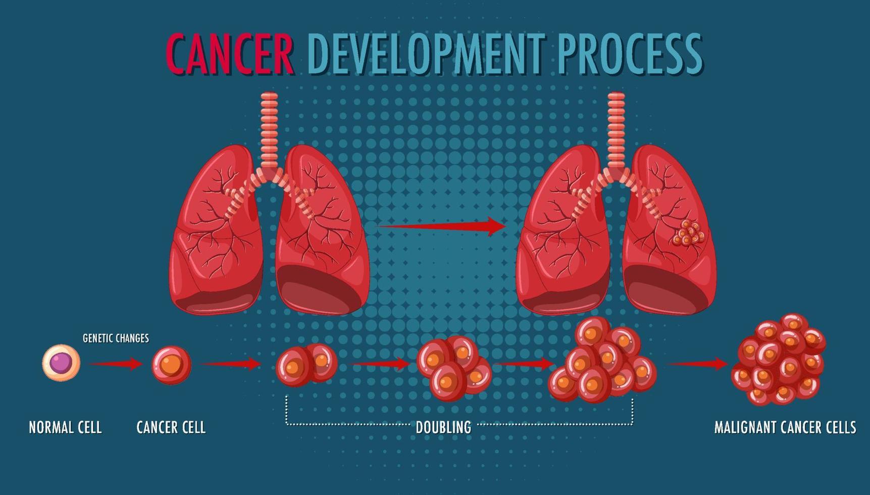 infográfico de processo de desenvolvimento de câncer vetor