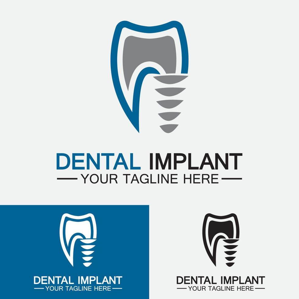 conceito de design de vetor de logotipo de implante dentário