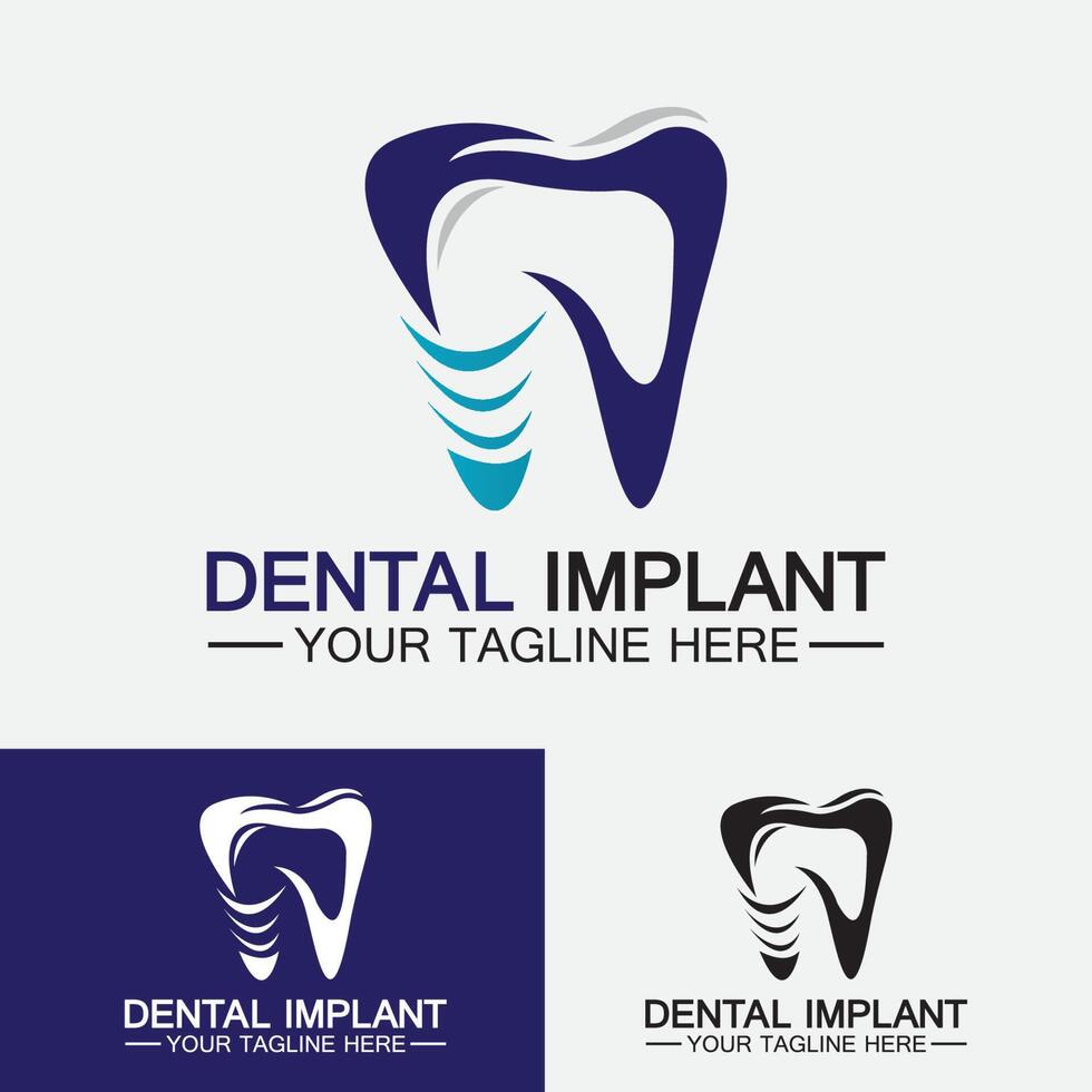 conceito de design de vetor de logotipo de implante dentário