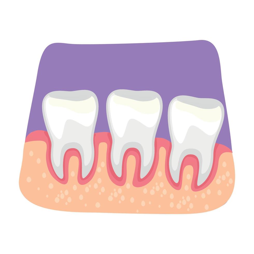 ilustração isolada em vetor 2d de inflamação dos dentes