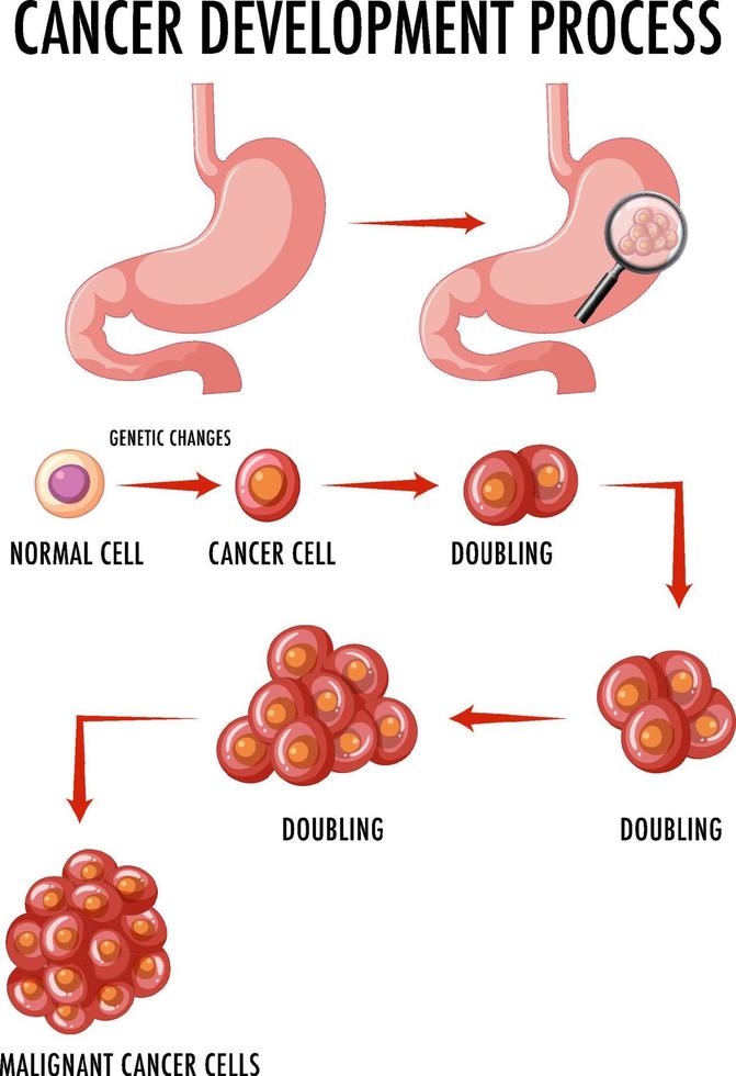 diagrama mostrando o processo de desenvolvimento do câncer vetor