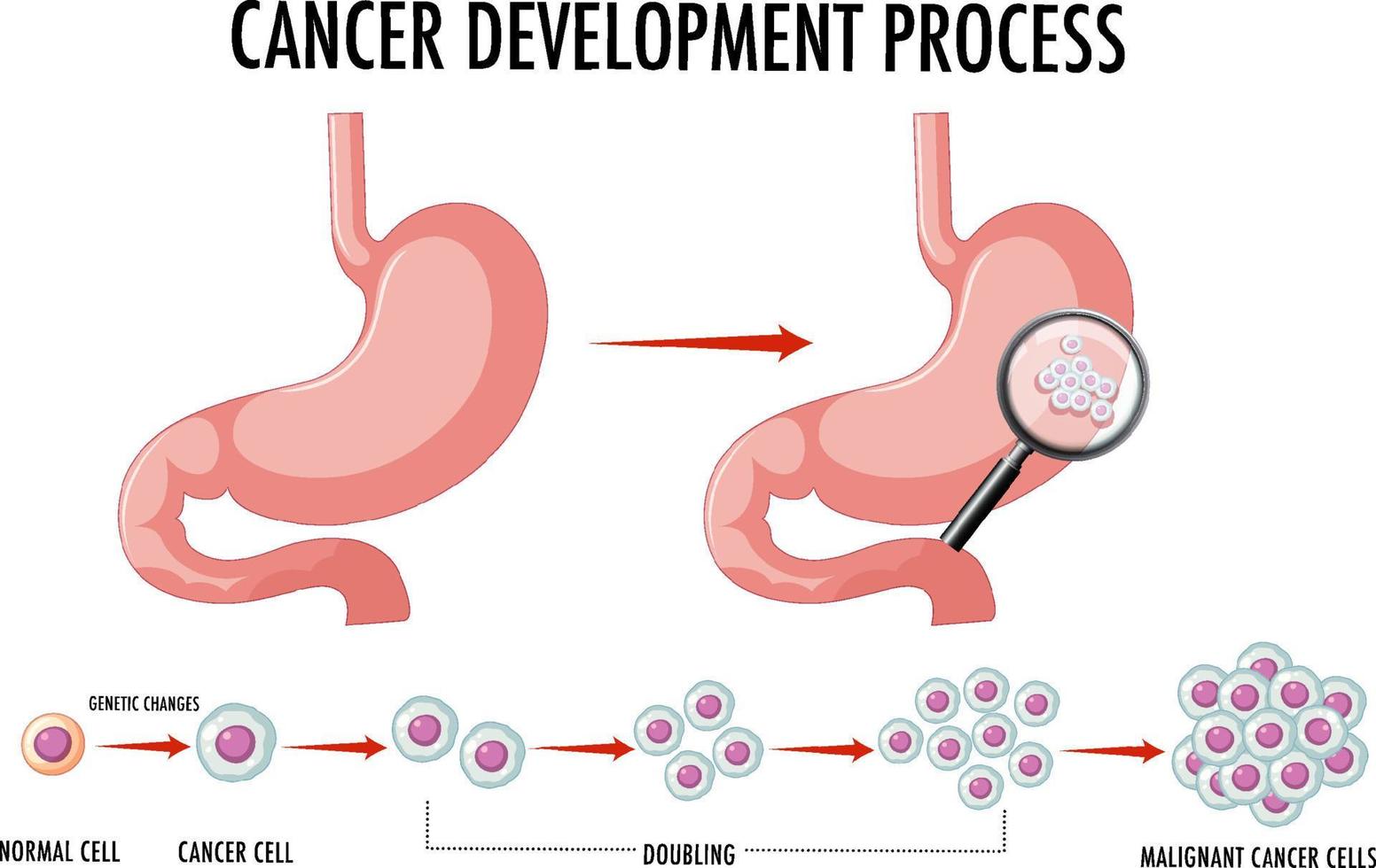 diagrama mostrando células normais e cancerosas em humanos vetor