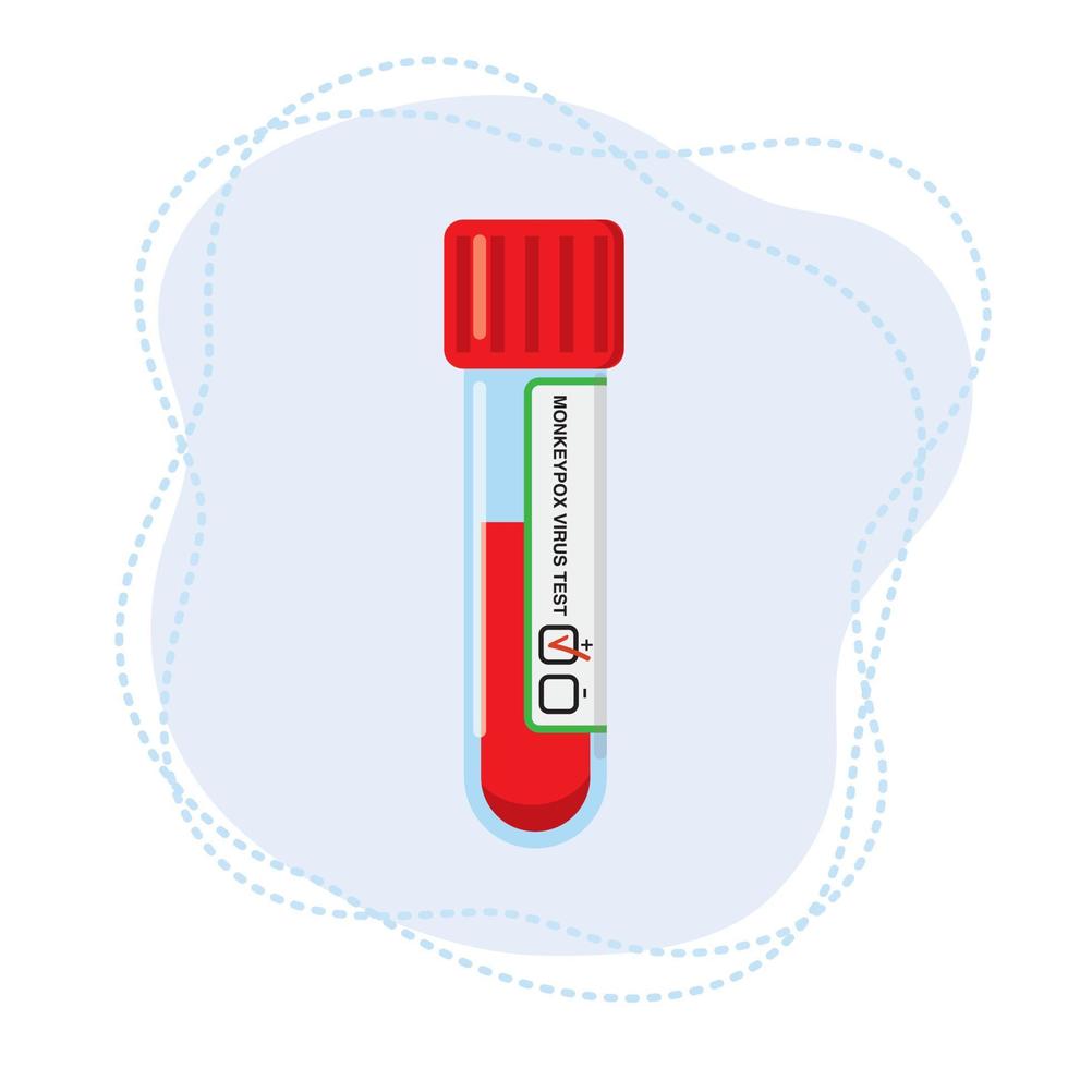 tubo de ensaio com sangue para a determinação do vírus da varíola dos macacos. vetor