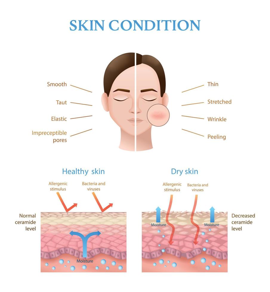 infográficos de estrutura da pele vetor