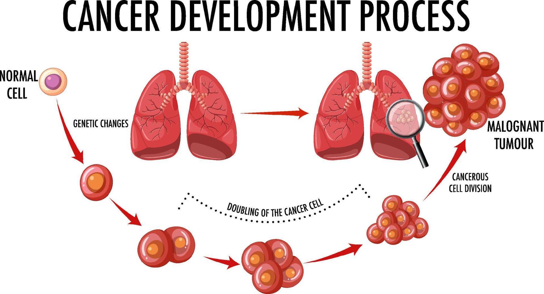 diagrama mostrando o processo de desenvolvimento do câncer vetor