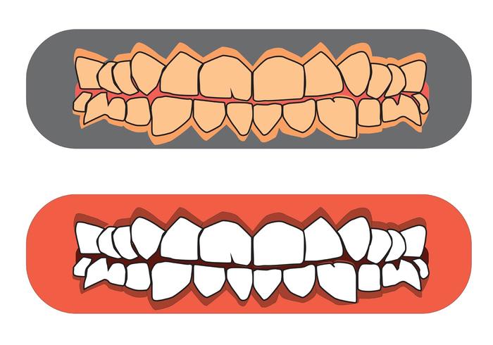 Vetores livres de dentes e gomas