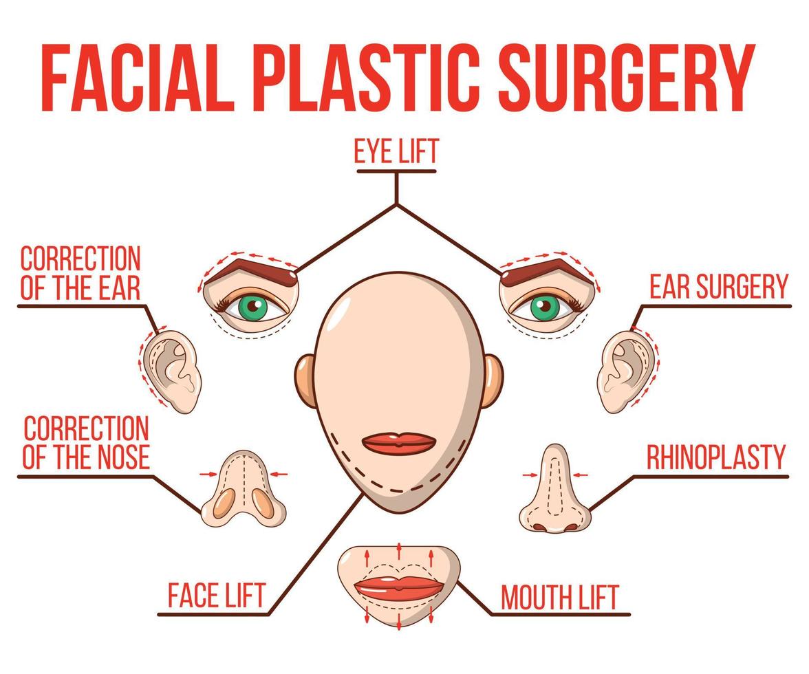 banner de conceito de cirurgia plástica facial, estilo cartoon vetor