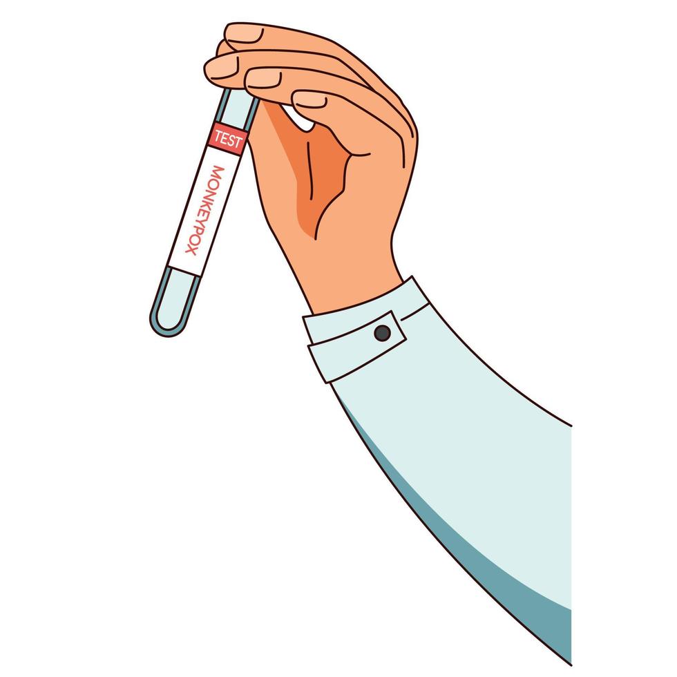 ilustração representando uma mão segurando um tubo de ensaio do exame do vírus da varíola dos macacos vetor