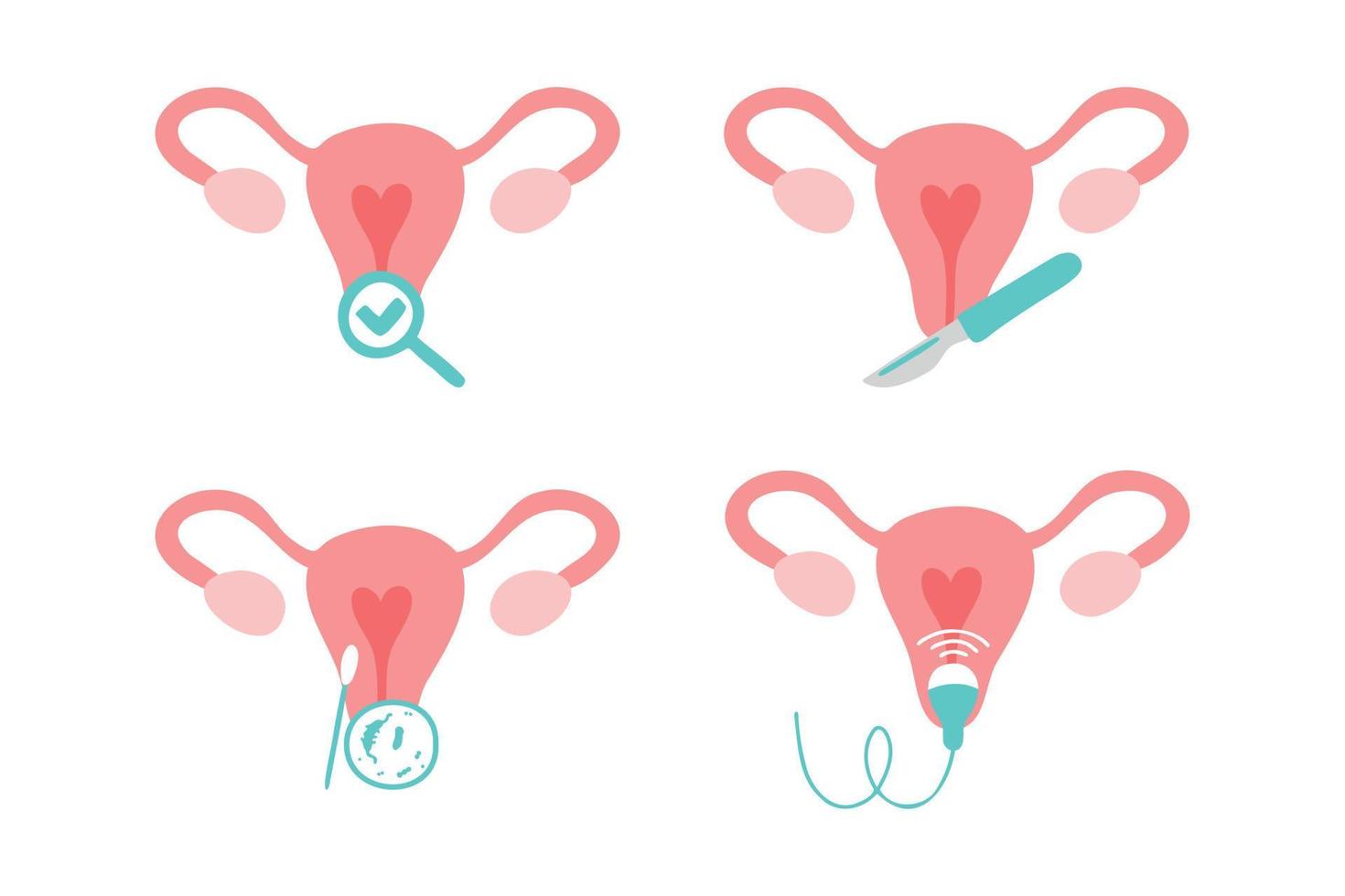 conjunto de ícones de ginecologia. ultra-som, check-up, teste de bactérias, cirurgia ginecológica. vetor