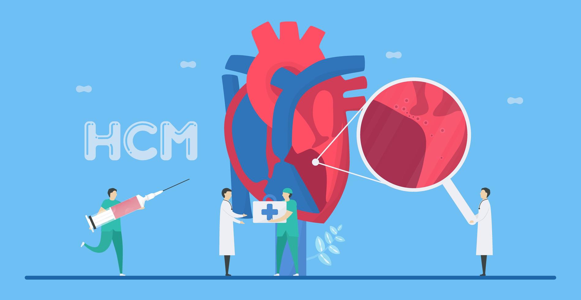 cardiomiopatia hipertrófica conceito de doença hcm vetor