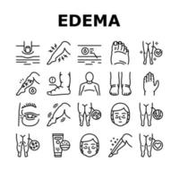 conjunto de ícones de coleção de sintomas de doença de edema vetor