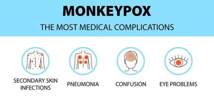 infográfico de ícones do vírus da varíola dos macacos. as maiores complicações médicas. novos casos de surtos na europa e nos eua. vetor