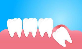 dentes do siso causam dor nas gengivas vetor