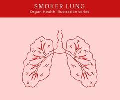 ilustração de pulmão de fumante doente contorno arte de linha estilo monoline vetor