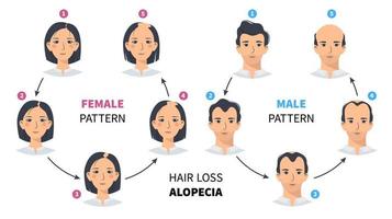 estágios de perda de cabelo, alopecia androgenética padrão masculino e feminino. passos de infográfico de círculo de vetor de calvície em um estilo simples com um homem e uma mulher. mudando a linha do cabelo no couro cabeludo