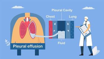 doença pulmonar sobre derrame pleural. vetor