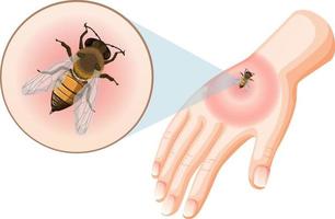 picadas de abelhas picam na pele vetor
