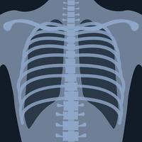radiografia de tórax na posição vertical para pesquisa médica e ensino vetor