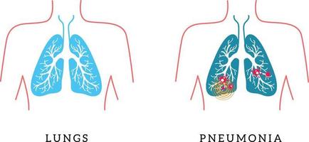 ilustração vetorial de ícone de pulmões para designer. vetor